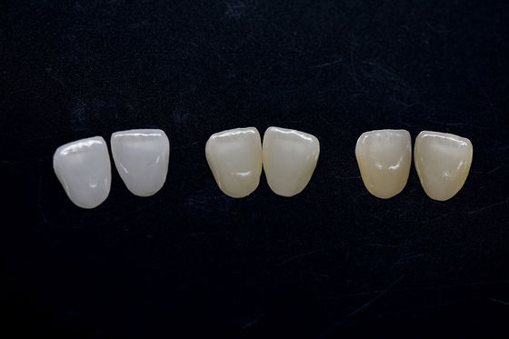 खरीदें उच्च सौंदर्य Zirconia Veneer लंबे समय तक चलने वाला Zirconia Emax Veneers online manufacture