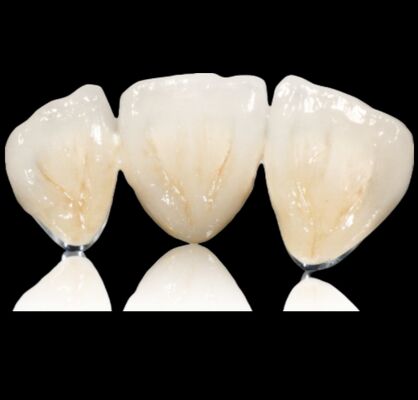 खरीदें अनुकूलन योग्य अर्ध कीमती मुकुट या पुल कीमती मिश्र धातु मुकुट और पुल online manufacture