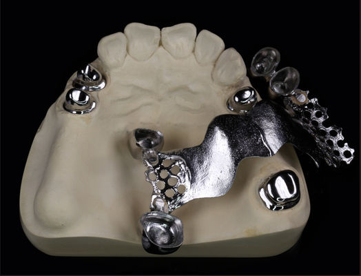 दूरबीन धातु मुकुट और पुल दंत और Orthodontic के लिए