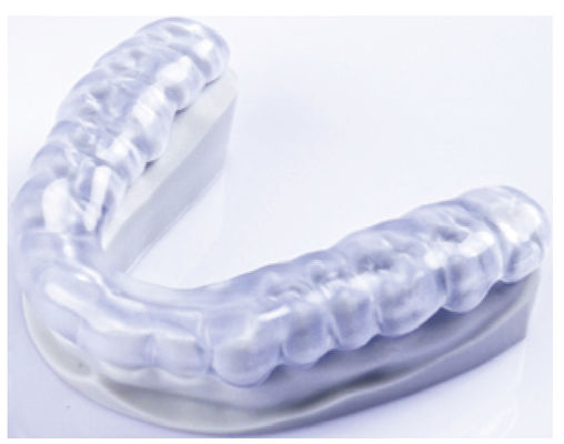 पारदर्शी दंत नरम स्प्लिंट 3 डी मुद्रित Orthodontics उपकरण