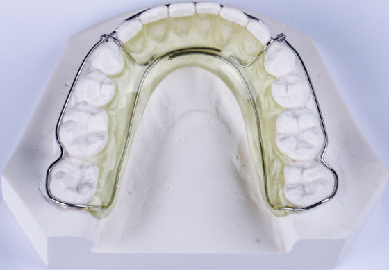 SS नैनस उपकरण Orthodontics स्टेनलेस स्टील नैनस दंत उपकरण